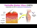 Chickenpox and Shingles Varicella-Zoster Virus