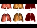 Lung segmentation with using Region Growing