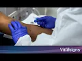 CDC Vital Signs Preventing Bloodstream Infections in People on Dialysis