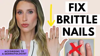 Fix Brittle Nails How to Naturally Grow Stronger Nails Dr Sam Ellis