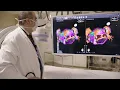 Atrial Fibrillation and Catheter Ablation NEJM