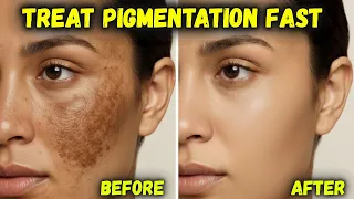 PIGMENTATION GONE in 7 DAYS 😱 Remove Dark Spots & Acne Scars Fast | Skin Brightening Home Remedies