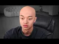Download Lagu I Went Bald..