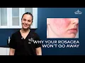 Rosacea Explained Triggers Treatment What to Avoid