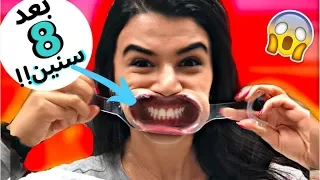 شلت التقويم نهائيا بعد 8 سنين شوفوا النتيجة  شلت التقويم نهائيا بعد 8 سنين شوفوا النتيجة