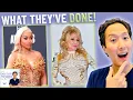 Celebrity Plastic Surgery Update Dolly Parton Sharon Osbourne Donald Trump Blac Chyna
