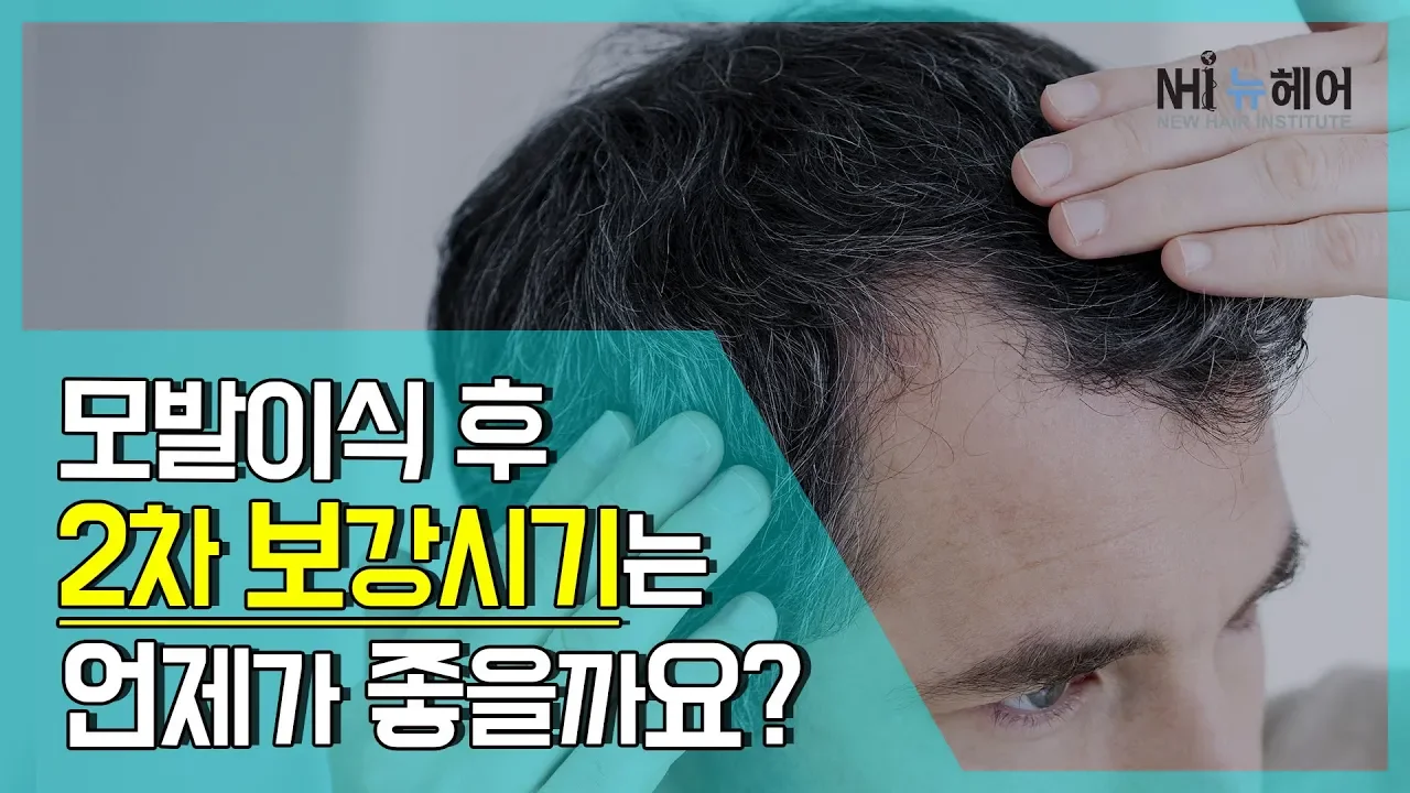 모발이식 후 2차 보강시기는 언제가 좋을까? (뉴헤어연구소)