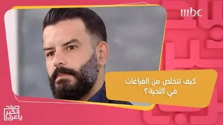 طريقة جديدة للتخلص من الشعر الأبيض والفراغات في اللحية دندنها