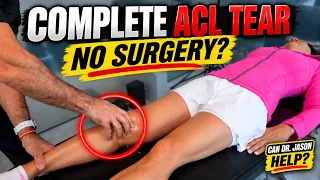 My Wife Completely Tore Her ACL. Can I Help Her Avoid Surgery?