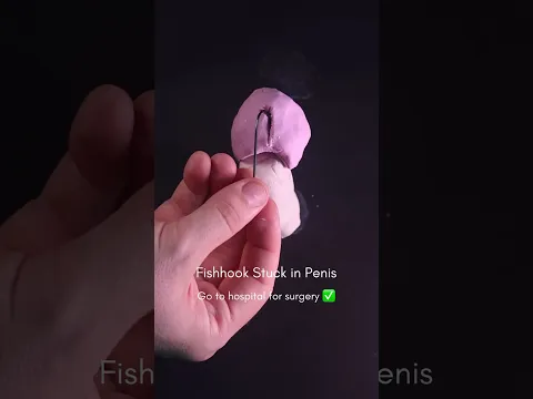 Fishhook stuck in your penis? Try this…