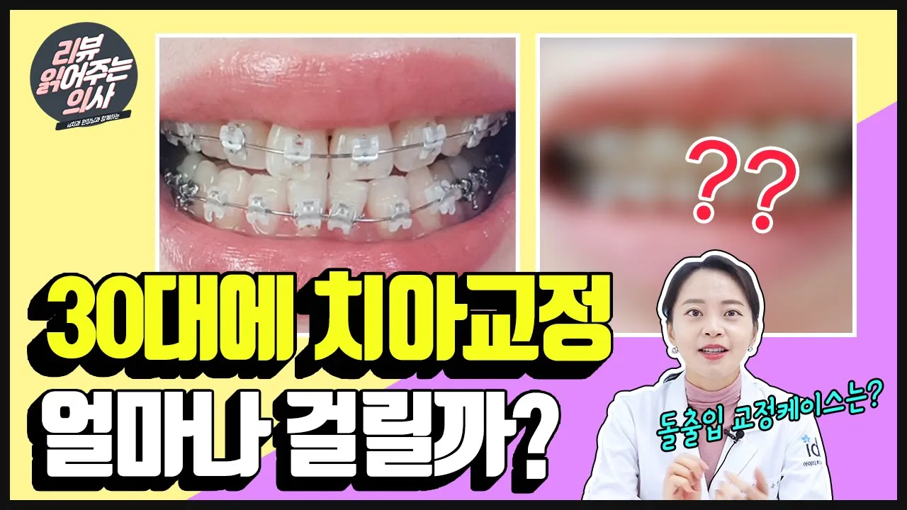 문정 아이디치과 │치아교정만으로 비대칭교정이 가능한가요?