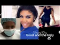 BBL Surgery Day The Good Bad and the Ugly - Avana Plastic Surgery