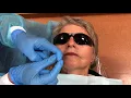 Posterior Superior Alveolar Nerve Block