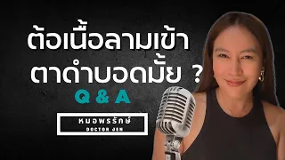 ต้อเนื้อที่เข้าตาดำจะเป็นอันตรายไหม และขึ้นอยู่กับอะไรบ้าง