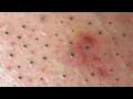 Satisfying and Relaxation with SURI NGUYEN Beauty Spa