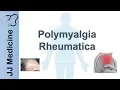 Polymyalgia Rheumatica | Signs \u0026 Symptoms, Diagnosis and Treatment