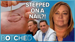 Lita Stepped On A NAIL and It Caused A Lifelong Painful Growth Under Her Foot | Botched | E!
