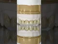 Download Lagu Anterior Monet Pure Zirconia Crowns #lsk121shorts #dentist #teeth