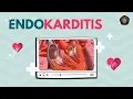 Download Lagu Waspada Penyakit Jantung: ENDOKARDITIS !