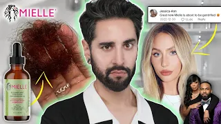 Gaslighting Hair Loss Lawsuits - Tikok s Viral Mielle Rosemary Hair Oil Scandal