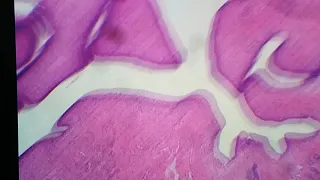 Histologia Útero
