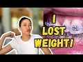 10 Uncommon Things I Learned From My First Orthodontic Treatment