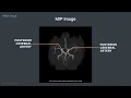 MRI Cross Sectional Anatomy of the Vascular Head and Neck