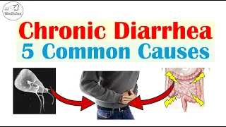 5 Common Causes of Chronic Diarrhea (Many People Don't Know About #4)