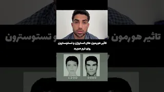 تاثیر هورمون های استروژن و تستوسترون  هورمون های زنانه و مردانه  روی فرم صورت دندنها