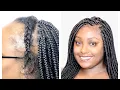 LACE FRONTAL BOX BRAIDS FOR THINNING HAIR - NO WIG NEEDED