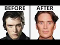 Cillian Murphy All Natural Plastic Surgery Analysis
