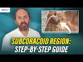 Download Lagu How to Scan the Subcoracoid Region: Step-by-Step MSK Ultrasound Guide for Clinicians