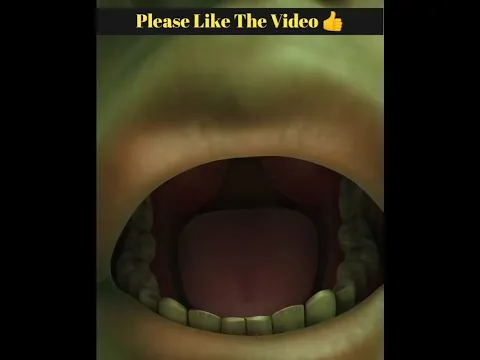 Alert 🚨 দাঁত যখন জীবন কেড়ে নেয় 😮 @mayajaalbangla #shortsviral #shortvideos