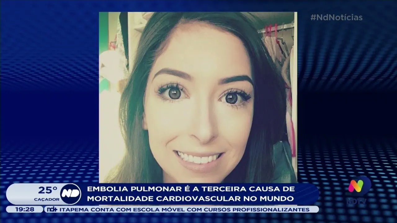 Embolia pulmonar é a terceira causa de mortalidade cardiovascular