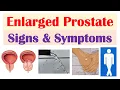 Enlarged Prostate Signs Symptoms Why They Occur