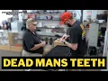 He Brought His Friends Gold Teeth Into The Pawn Shop
