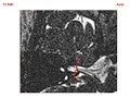 MRI Inner EAR Normal Findings T2