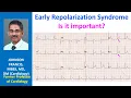 Early Repolarization Syndrome Is it important