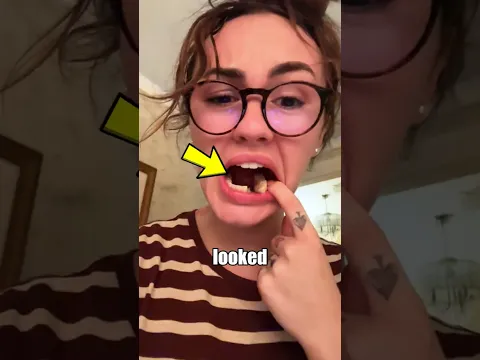 This girl found something shocking inside her tooth... 😍🦷 #shorts