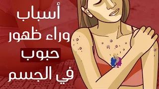 هل ظهرت في جسمك حبوب حمراء فجأة لا تتعاملي على أنها مجرد حساسية قد تكون نذيرا بإصابتك بأمراض أخرى 