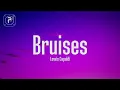 Lewis Capaldi - Bruises