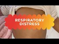 Respiratory distress in children - fast noisy breathing