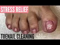 Download Lagu Stress Relief Toenail Cleaning No Talking