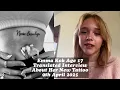 Download Lagu Emma Kok, age 17, Interview 09 April 2025: about her brave and cool tattoo above her Mickey Button