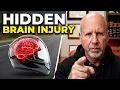 Feeling Fine After a Motorcycle Crash Your BRAIN Is NOT Ok