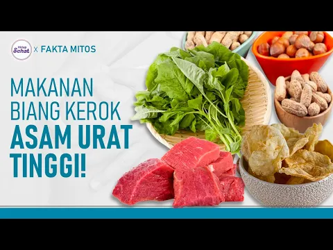 Asam Urat Tak Kunjung Turun? Kurangi Makan Makanan Ini
