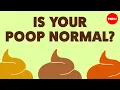 What your poop can tell you about your health - Hannibal Person