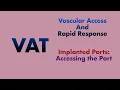 Implanted Ports Accessing The Port