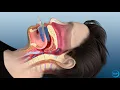 flexTAP Oral Appliance for Sleep Apnea How Does It Work