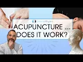 Does Acupuncture Work in Physiotherapy Expert Physio Reviews the Evidence